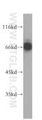 Mi antibody, 13092-1-AP, Proteintech Group, Western Blot image 