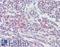 Killer Cell Lectin Like Receptor C1 antibody, LS-C165590, Lifespan Biosciences, Immunohistochemistry paraffin image 