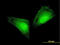 S100 Calcium Binding Protein A11 antibody, LS-C133421, Lifespan Biosciences, Immunofluorescence image 