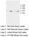 High Mobility Group Box 4 antibody, LS-C171753, Lifespan Biosciences, Western Blot image 