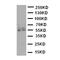 Cytochrome P450 19A1 antibody, orb47956, Biorbyt, Western Blot image 