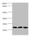 NADH dehydrogenase [ubiquinone] 1 beta subcomplex subunit 5, mitochondrial antibody, orb350618, Biorbyt, Western Blot image 