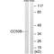 Transmembrane Protein 30B antibody, A13764, Boster Biological Technology, Western Blot image 