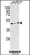 TRNA Methyltransferase O antibody, 62-550, ProSci, Western Blot image 