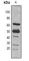 Ribulose bisphosphate carboxylase large chain antibody, LS-C413588, Lifespan Biosciences, Western Blot image 