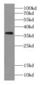 Retinol Dehydrogenase 14 antibody, FNab07220, FineTest, Western Blot image 