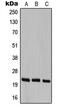 Cerebellin 1 Precursor antibody, MBS820708, MyBioSource, Western Blot image 