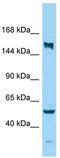 Kinesin Family Member 24 antibody, TA334315, Origene, Western Blot image 