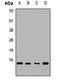 Mitochondrial Ribosomal Protein S16 antibody, LS-C668756, Lifespan Biosciences, Western Blot image 