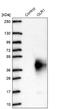 LOX1 antibody, NBP2-76543, Novus Biologicals, Western Blot image 
