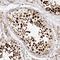 Cell Division Cycle Associated 2 antibody, HPA030049, Atlas Antibodies, Immunohistochemistry frozen image 