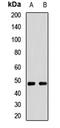 Solute Carrier Family 16 Member 11 antibody, LS-C668981, Lifespan Biosciences, Western Blot image 