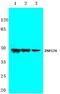 Zinc Finger Protein 174 antibody, PA5-36201, Invitrogen Antibodies, Western Blot image 
