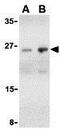 B Cell Receptor Associated Protein 29 antibody, GTX85072, GeneTex, Western Blot image 