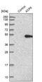 Lpap antibody, PA5-55900, Invitrogen Antibodies, Western Blot image 
