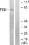 FPS antibody, LS-C118761, Lifespan Biosciences, Western Blot image 