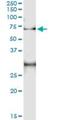 ACD antibody, H00065057-M01, Novus Biologicals, Immunoprecipitation image 