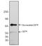 Cholesteryl Ester Transfer Protein antibody, GTX19012, GeneTex, Western Blot image 