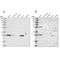 Biphenyl Hydrolase Like antibody, NBP1-88373, Novus Biologicals, Western Blot image 