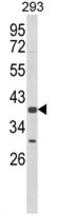 Chondroitin Sulfate N-Acetylgalactosaminyltransferase 2 antibody, AP17956PU-N, Origene, Western Blot image 