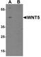 Wnt Family Member 5B antibody, PA5-72844, Invitrogen Antibodies, Western Blot image 
