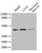 Aspartate aminotransferase, cytoplasmic antibody, A52800-100, Epigentek, Western Blot image 