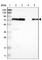 Lipoma-preferred partner antibody, HPA011133, Atlas Antibodies, Western Blot image 