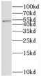Sushi Repeat Containing Protein X-Linked 2 antibody, FNab08240, FineTest, Western Blot image 
