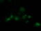 Suppressor Of Cytokine Signaling 3 antibody, TA502959, Origene, Immunofluorescence image 