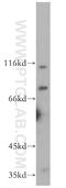 Microcephalin 1 antibody, 11962-1-AP, Proteintech Group, Western Blot image 