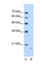 Amyloid P Component, Serum antibody, NBP1-58970, Novus Biologicals, Western Blot image 