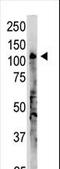 2'-5'-Oligoadenylate Synthetase 3 antibody, LS-C100475, Lifespan Biosciences, Western Blot image 