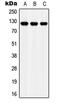 LDL Receptor Related Protein 8 antibody, MBS820932, MyBioSource, Western Blot image 