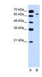 Keratin, type II cytoskeletal 2 epidermal antibody, NBP1-55126, Novus Biologicals, Western Blot image 
