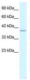 Regulating Synaptic Membrane Exocytosis 3 antibody, TA338081, Origene, Western Blot image 