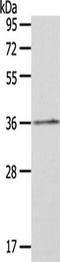 Homeobox A11 antibody, TA322598, Origene, Western Blot image 