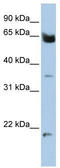 Homeobox And Leucine Zipper Encoding antibody, TA342470, Origene, Western Blot image 