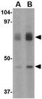 Probable ATP-dependent RNA helicase DHX58 antibody, GTX16996, GeneTex, Western Blot image 