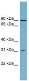 ATP Binding Cassette Subfamily D Member 2 antibody, TA332070, Origene, Western Blot image 