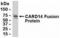 Caspase Recruitment Domain Family Member 14 antibody, XW-7891, ProSci, Western Blot image 