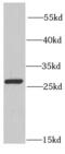 Peroxiredoxin 6 antibody, FNab06759, FineTest, Western Blot image 
