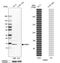 Fatty Acid Binding Protein 5 antibody, HPA051895, Atlas Antibodies, Western Blot image 