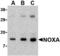 Phorbol-12-myristate-13-acetate-induced protein 1 antibody, A02287, Boster Biological Technology, Western Blot image 