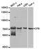 Complement factor B antibody, TA327148, Origene, Western Blot image 