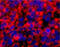 Mucin 16, Cell Surface Associated antibody, 250566, Abbiotec, Immunohistochemistry paraffin image 