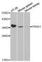 Serine Protease 1 antibody, A1242, ABclonal Technology, Western Blot image 
