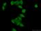 BCL9 Transcription Coactivator antibody, 22947-1-AP, Proteintech Group, Immunofluorescence image 