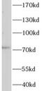 Cytosolic carboxypeptidase 3 antibody, FNab00207, FineTest, Western Blot image 