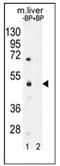 Sterile Alpha Motif Domain Containing 8 antibody, AP53793PU-N, Origene, Western Blot image 