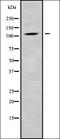 Carbonic Anhydrase 8 antibody, orb338129, Biorbyt, Western Blot image 